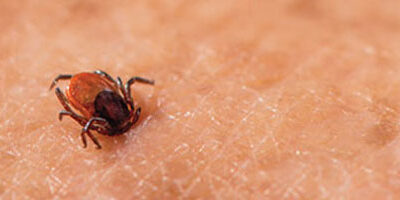 Ticks and Lyme disease