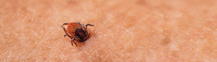 Ticks and Lyme disease